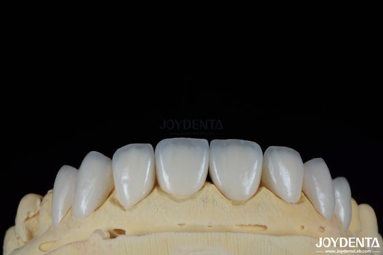 Купить Глянцевая поверхность текстура Feldspathic фанера натурального вида фарфоровый фанера онлайн изготовление