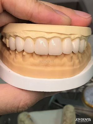 Купить 16 оттенков Цвет Emax Зубные фанеры А1-А4 Высокая стойкость к пятнам для идеальной улыбки онлайн изготовление