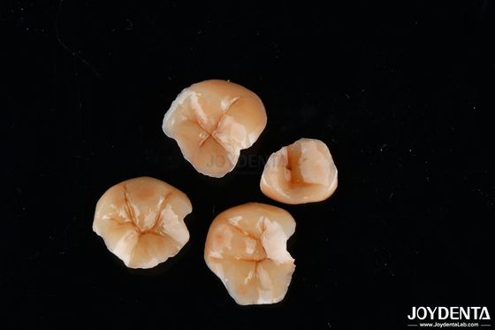 Купить Настраиваемая форма композитные вкладыши и вкладыши устойчивость к зубным пятнам долговечность онлайн изготовление