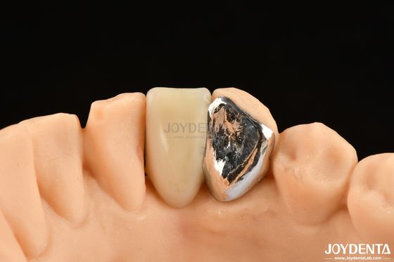 Купить Идеальное сочетание клинических связей Maryland Dental For Oral Clinical Repair Work онлайн изготовление