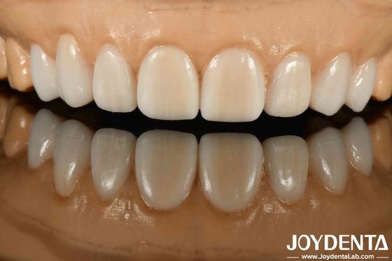 Купить Высокая скрытность Различные материалы из металлов и смол Гибкая протеза для передовых технологий скрытности онлайн изготовление