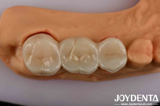 Купить Высокопрочная зубная циркония - лучшее решение для естественного вида онлайн изготовление