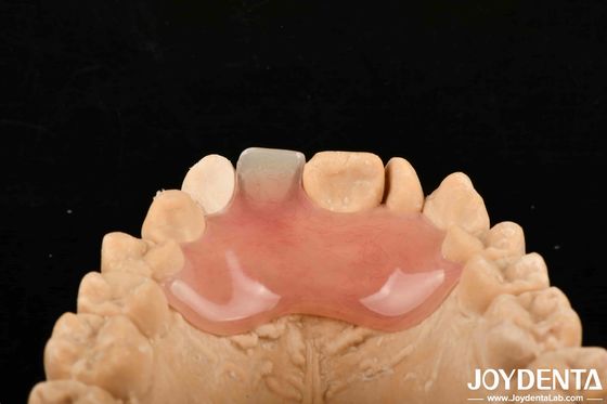 Купить Высокая скрытость, хорошая эластичность, гибкая протеза для различных производственных процессов онлайн изготовление