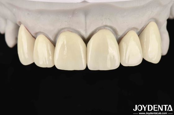 Купить 6.0-6.1 G/cm3 Плотность слоистый циркония для высокой прозрачности в CAD / CAM фрезерной онлайн изготовление
