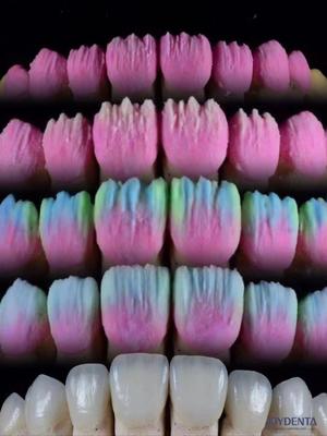 Купить The Joydenta Ceramic Veneer Process онлайн изготовление