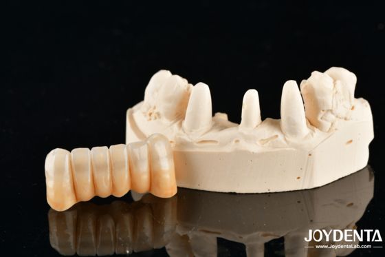 Купить Unveil True Biomimicry: Introducing Our Multi-Layered Zirconia Aesthetic Bridge онлайн изготовление