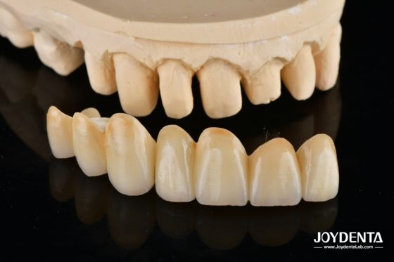 Купить Unveil True Biomimicry: Introducing Our Multi-Layered Zirconia Aesthetic Bridge онлайн изготовление