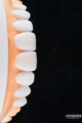 Купить Enhance Case Acceptance & Patient Communication with Our Diagnostic Wax-Up Service онлайн изготовление