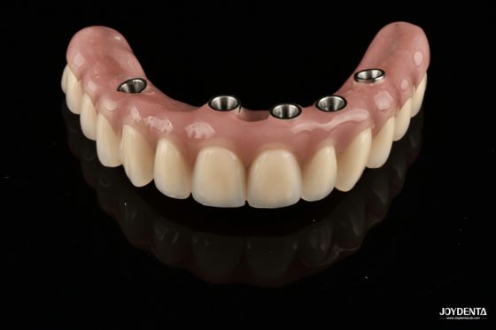 Купить Redefining Full Arch Prosthetics: Unmatched Fit and Function with Our Ti-Base Complete Dentures онлайн изготовление