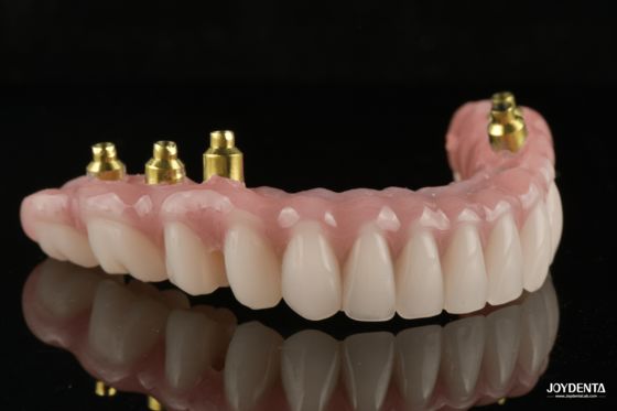 Купить The Strength of Titanium, The Art of Natural Aesthetics. онлайн изготовление