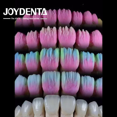 Купить The Joydenta Ceramic Veneer Process онлайн изготовление
