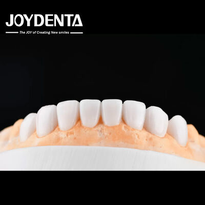 Купить Enhance Case Acceptance & Patient Communication with Our Diagnostic Wax-Up Service онлайн изготовление