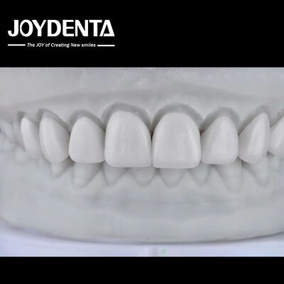 Купить Visualize the Result, Secure the Case: Our Diagnostic Wax-Up Service онлайн изготовление