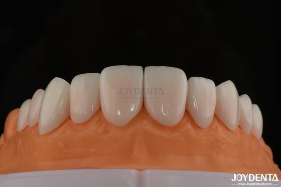 A1-A4 Ips Emax Press Порцелановые зубные фанеры Устойчивые к пятнам