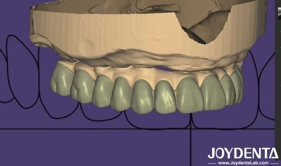Индивидуальный дизайн цифровой диагностики Wax Up Lab Программное обеспечение Бесшовная интеграция