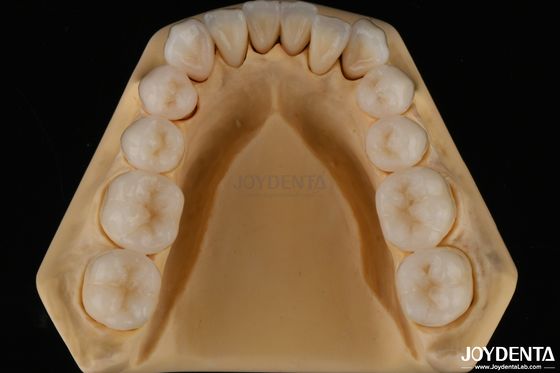 3D многослойный стоматологический полный цирконий сопротивление трещинам естественная структура зуба