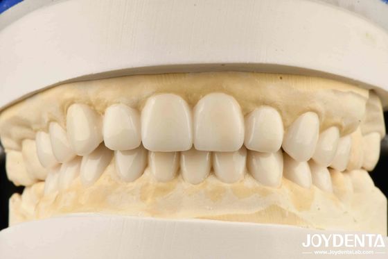 Стоматологическое биомиметическое эстетическое диагностическое осваивание фанеры