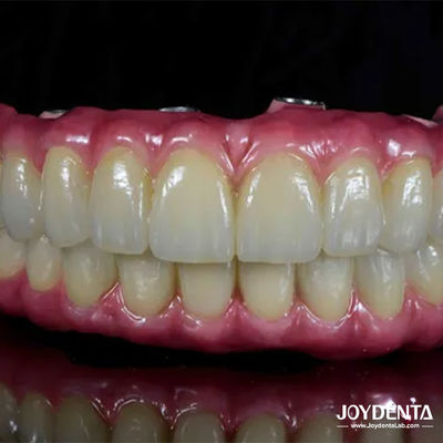 Легкий зубной Титановый Малонг Гибридный мост Удобный для восстановления зубов