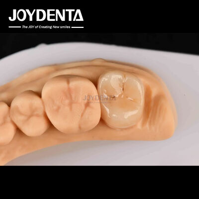 Высокая прочность Emax Inlay Onlay A2 цвет долговечный для восстановления поврежденных зубов