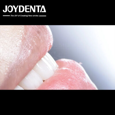 Долговечная зубная композитная фанера Хорошая биосовместимость Без капель фарфоровые фанеры