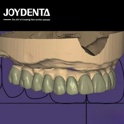 Индивидуальный дизайн цифровой диагностики Wax Up Lab Программное обеспечение Бесшовная интеграция